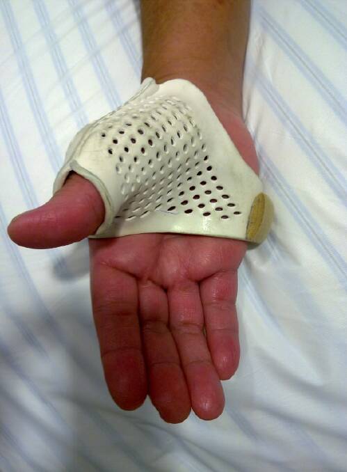 A hand splint.
