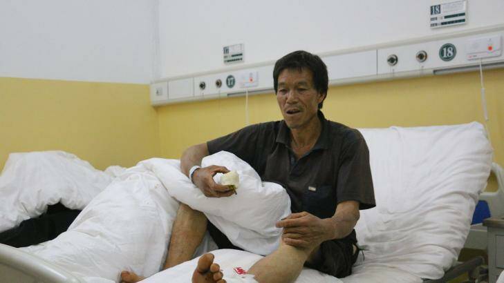 56-year-old Xiao Jinrong was sorting peppers when the earthquake hit and a falling wall shattered his ankle. Photo: Sanghee Liu