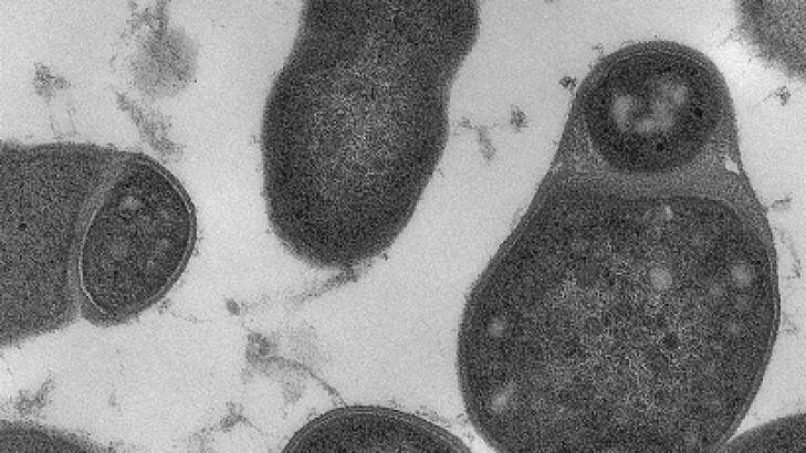 Nanoscale gut microbiota under the microscope. Photo: David Goulding, Wellcome Trust Sanger Institute