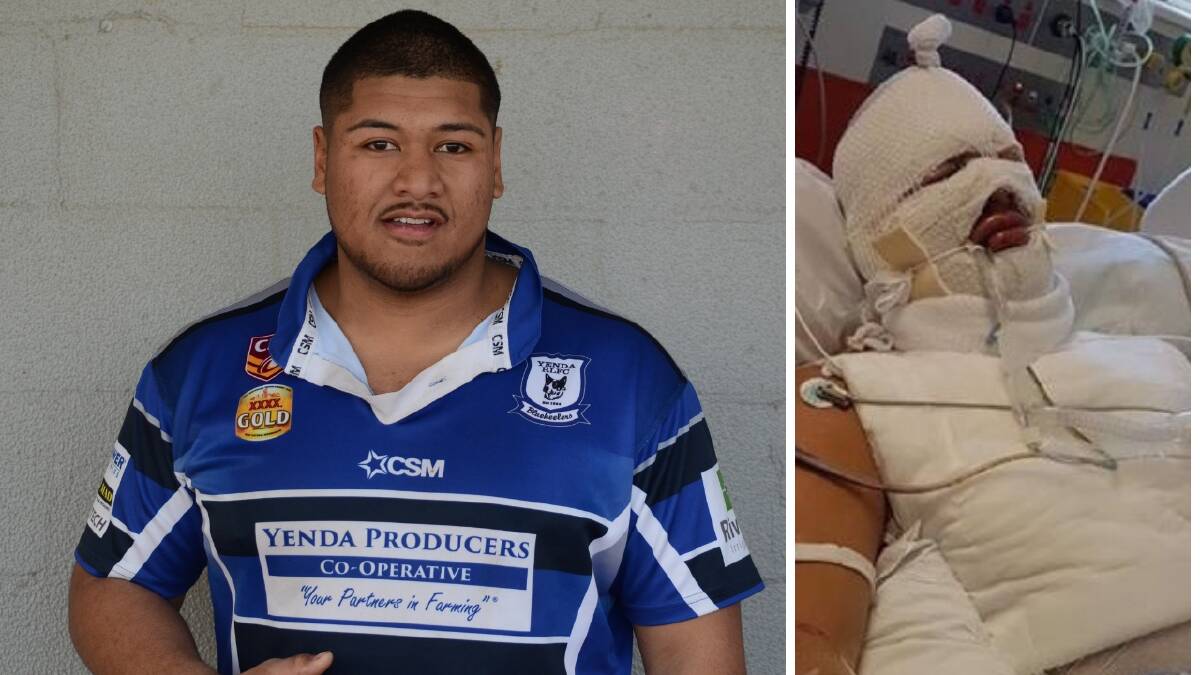 CRITICAL: Blue Heelers prop forward Semi Tafili the week before the grand final on Sunday (right), and his condition now (left picture: gofundme).
