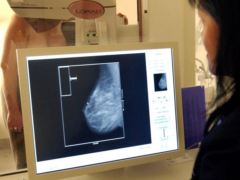 TAKE THE TEST: Screening programs, such as mammograms for detecting breast cancer, can save lives.