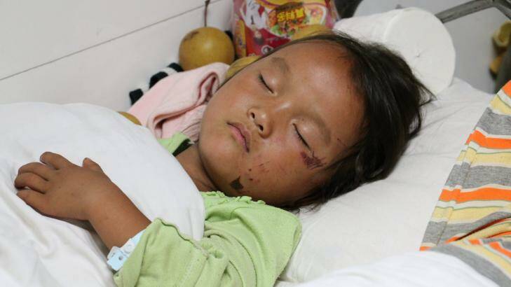A child victim of the earthquake at Ludian People's Hospital. Photo: Sanghee Liu